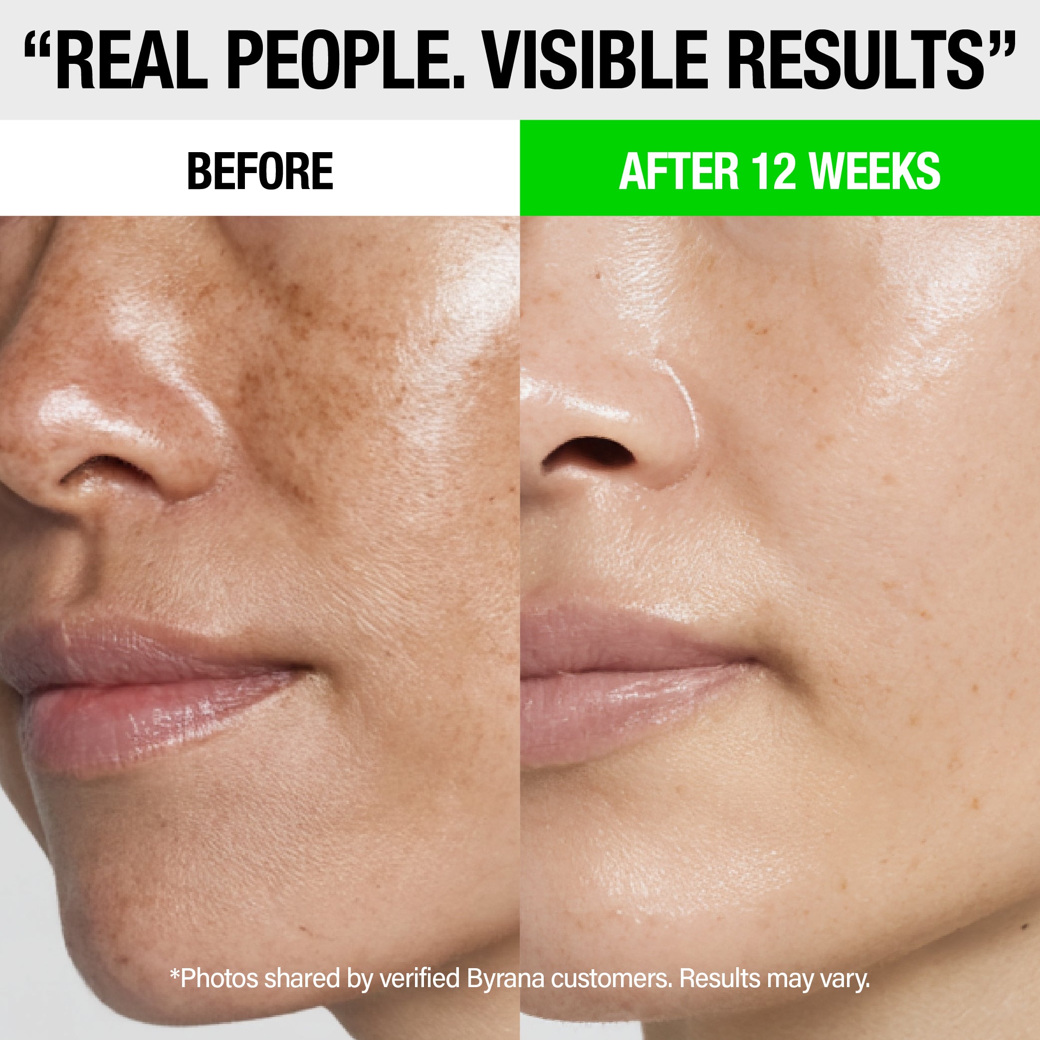 DARK SPOT CLARITY OIL WITH VITAMIN C